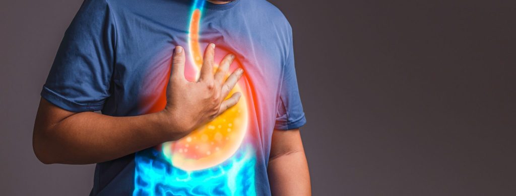 Comment éviter les brûlures d’estomac et les indigestions pendant les vacances-1