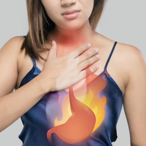 Comment éviter les brûlures d’estomac et les indigestions pendant les vacances ?