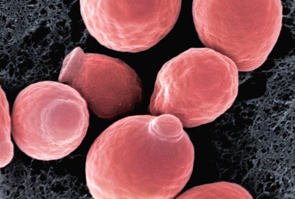 Le régime alimentaire Anti-Candidose : Utile ou Extravagant ? 