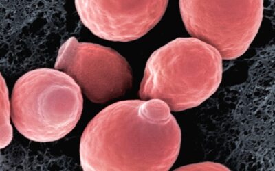 Le régime alimentaire Anti-Candidose : Utile ou Extravagant ? 