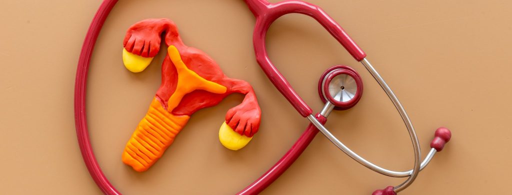 SOPK et l'inflammation-1